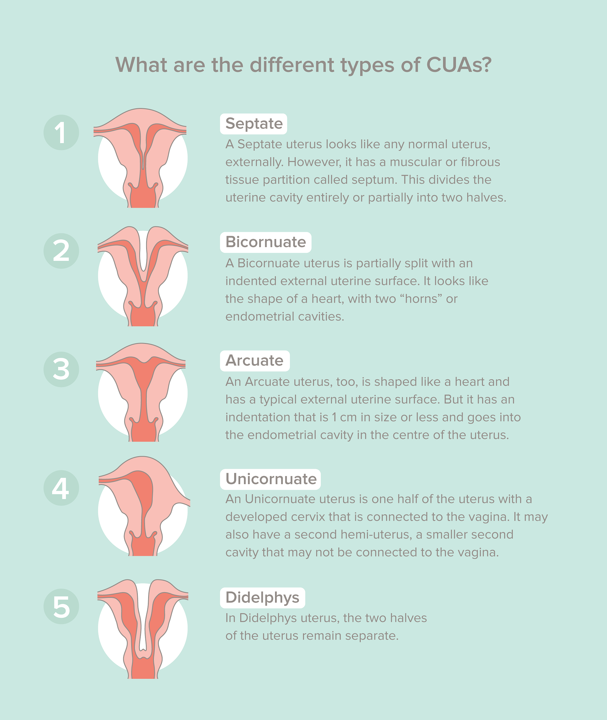 What are different  types of CUAs