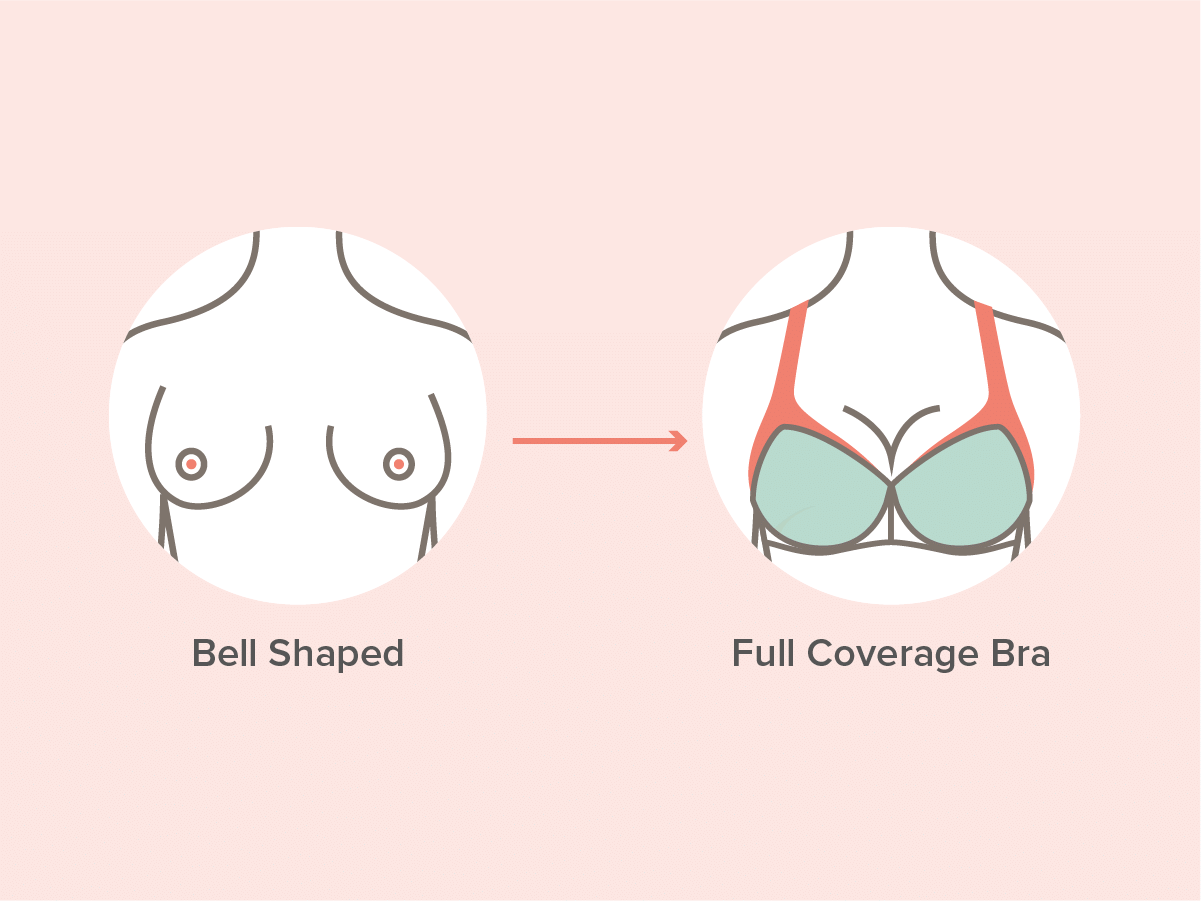 Pear shaped breast
